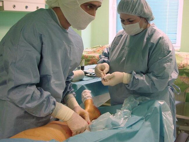 operācija varikozām vēnām