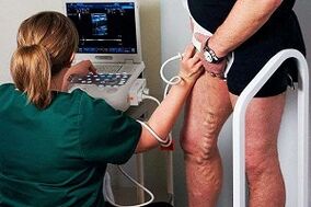 Diagnostikas iespējas varikozām vēnām uz kājām