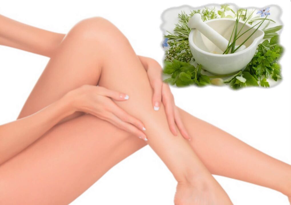 Varikozas vēnas attīstās, ja ir traucēta asinsrite